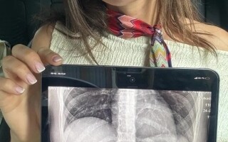 Woman Swallows Spoon After Dog Jumps on Her